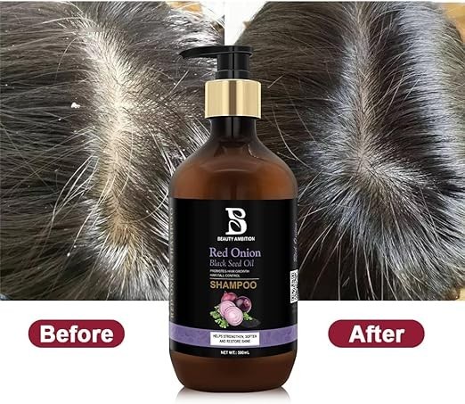 onion-hair-care-set-hair-shampoo-hair-conditioner-for-anti-breakage-and-strengthen-hair-pack-of-2-big-2