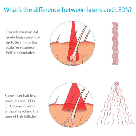 theradome-evo-laser-hair-growth-helmet-lh40-red-light-therapy-big-2